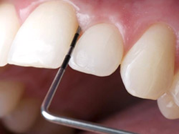 Diş Eti Tedavisi | Kavacık Beykoz Diş Kliniği