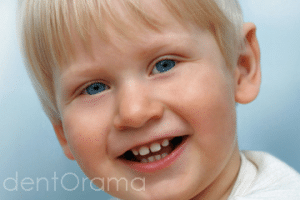 cocuklarda diş ayrıklığı